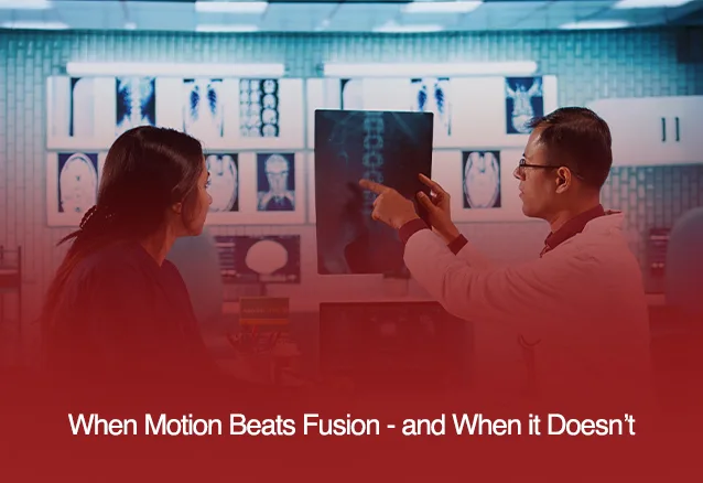 Motion Preservation vs. Fusion: What's Right for Your Spine?