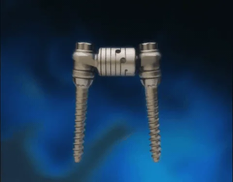 Posterior dynamic stabilization device