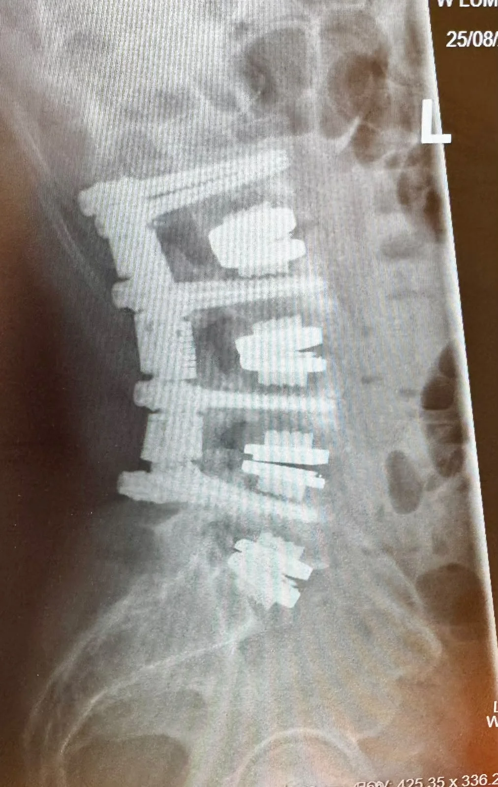 Motion 360 Surgery